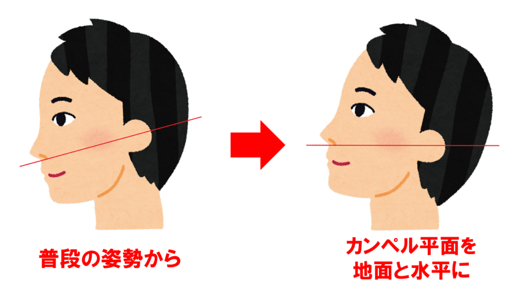 カンペル水平 カンペル水平